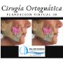 Maxilofacial en Saltillo Ortognática Mentón Botox