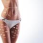 lipoescultura