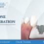 bone regeneration