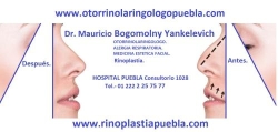 Otorrinolaringologo Puebla