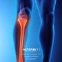 Artroscopia de Rodilla