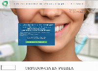Ortodoncia en Puebla