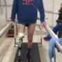 Protesis Transtibial