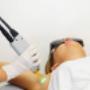 depilacion laser