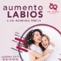 Aumento de labios
