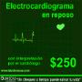 Electrocardiograma