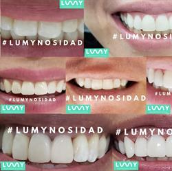 Lumy Dental Querétaro Centro Histórico