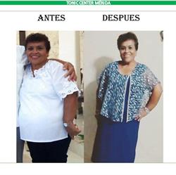 Tonic Center Mérida