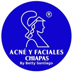 Acné Faciales Chiapas