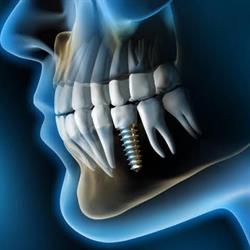 Dental Leal