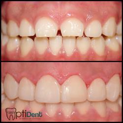 Dentista Optident