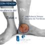 Úlcera Venosa