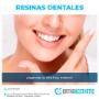 Resinas Dentales