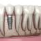Implante-dental