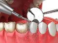 Periodoncia