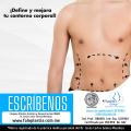Abdominoplastia