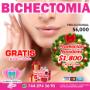 Bichectomia