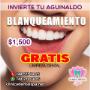 Blanqueamiento dental