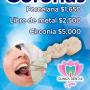 Coronas dentales