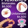 Flexibles Bilaterales y Unilaterales