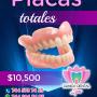 Placas dentales
