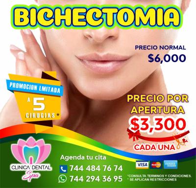 Bichectomia