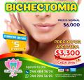 Bichectomia