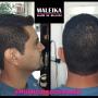 Corte de Cabello Caballero