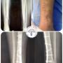 Fractura de Tibia por mínima invasión
