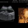 Ultrasonido 3D/4D