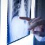 # 2