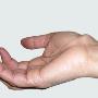 TUMORES DE MANO