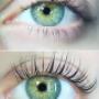 Antes e depois