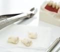 Extracciones dentales