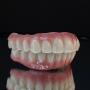 Hybrid Denture