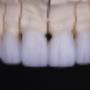 Our on Dental Lab
