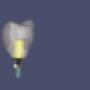 Perfect custom design for you dental implants