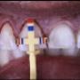 Periodontal Treatment