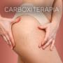 CARBOXITERAPIA