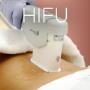 HIFU