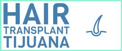 Hair Transplant Tijuana