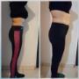 antes y despues
