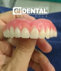GIDENTAL