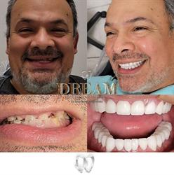 DENTAL NUEVA IMAGEN AND MED SPA