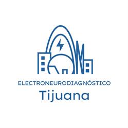 Electromiografia y Potenciales Evocados de Tijuana
