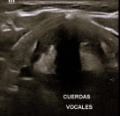 SONOGRAMAS