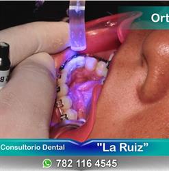 Consultorio Dental " La Ruiz "