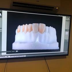 Laboratorio dental Blanco