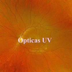 Opticas UV