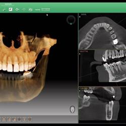 OdontoDigital Radiografias Dentales